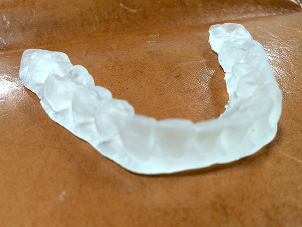 ３Dスキャナを利用した義歯の製作